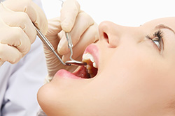 In Smile Dentistry Adult Exam and Cleaning Special